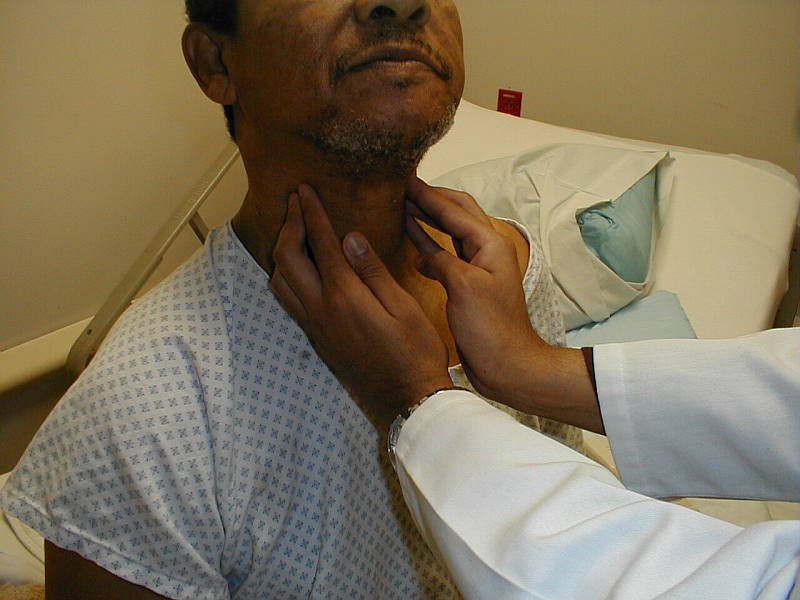 Subacute Thyroiditis Thyroid Clinic Sydney